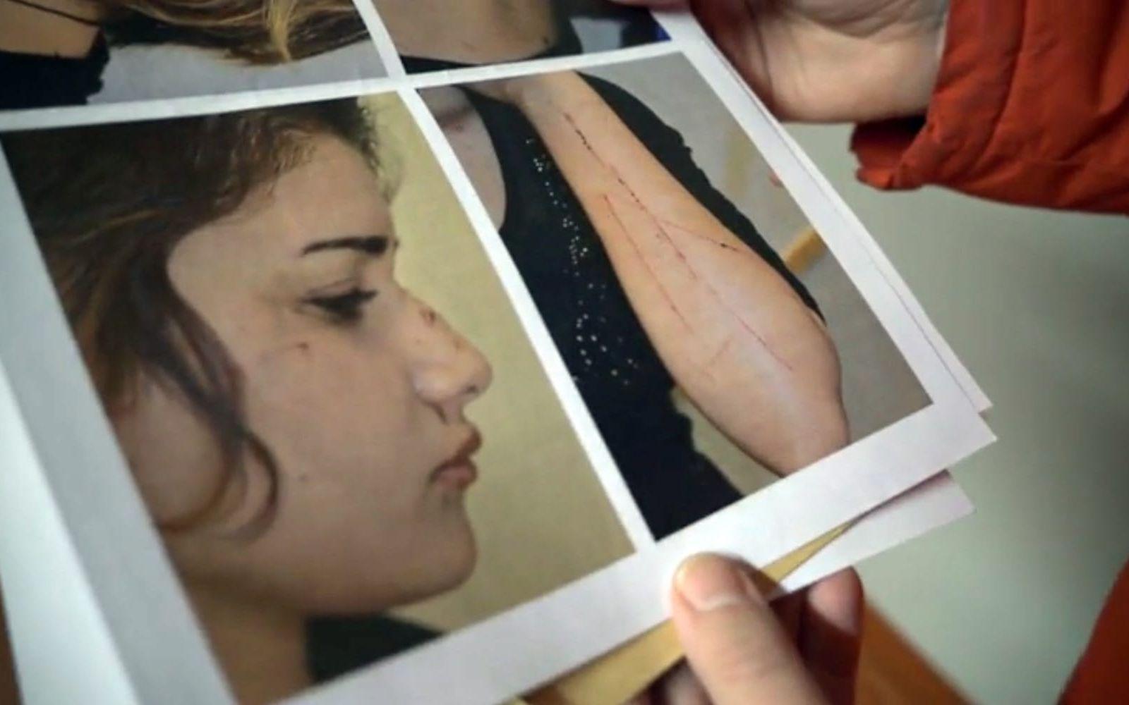Efter misshandeln försökte hennes läkare att få henne flyttad från boendet. Bild: TV4
