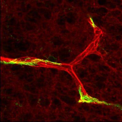 
    FoxF2 finns i en celltyp i hjärnans kapillärer som kallas pericyter. Det gröna i bilden visar en kapillär i hjärnan.
   