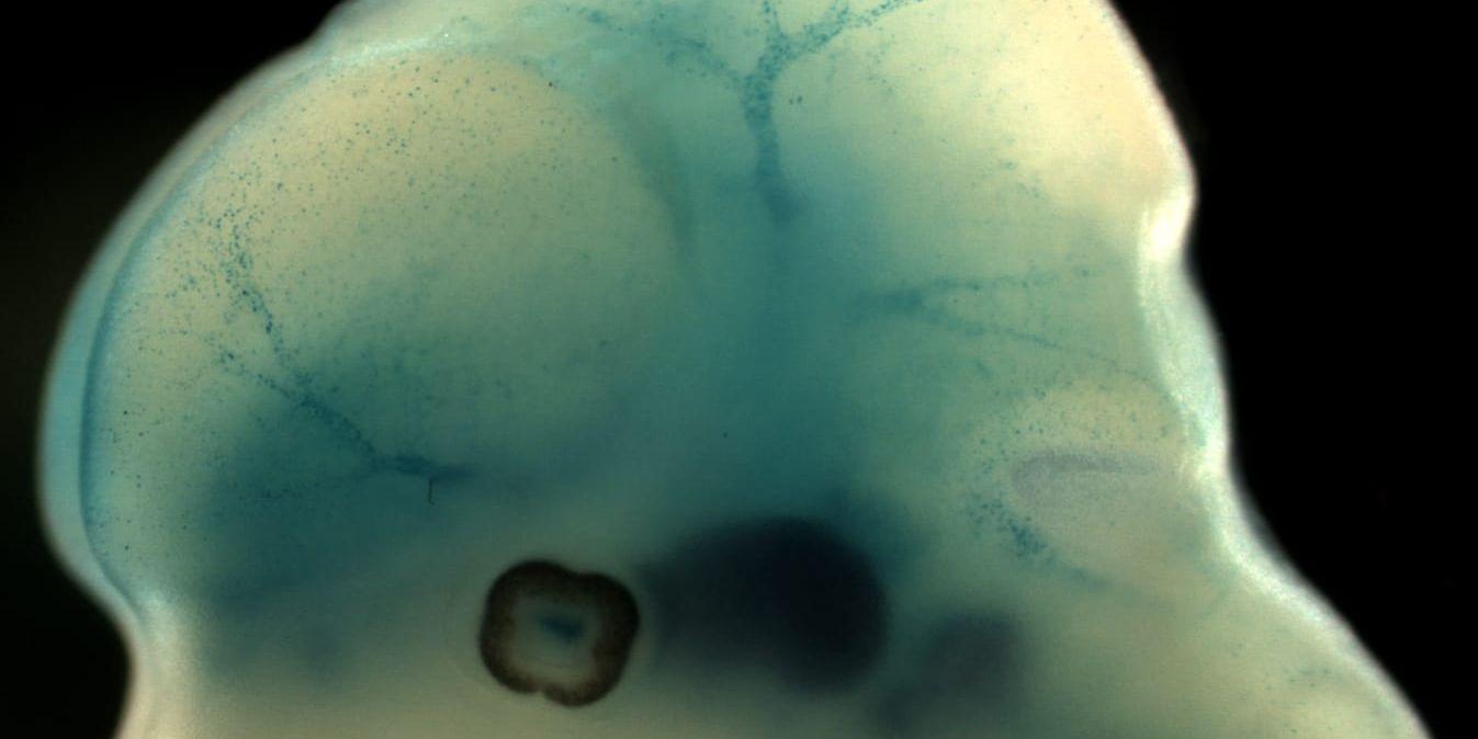
    FoxF2 finns i en celltyp i hjärnans kapillärer som kallas pericyter, det blåa i bilden, som visar huvudet av ett musembryo under 13:e dräktighetsdagen.
   