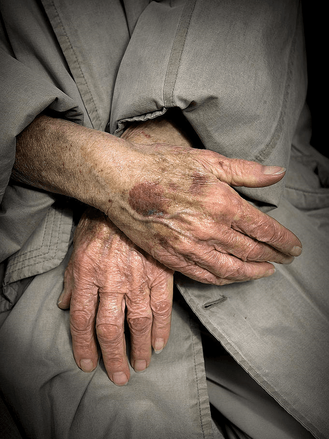 Efter 17 månader bakom galler tycker kvinnan att hon "blivit gammal". Arkivbild/Bild: Magnus Hjalmarsson Neiderman