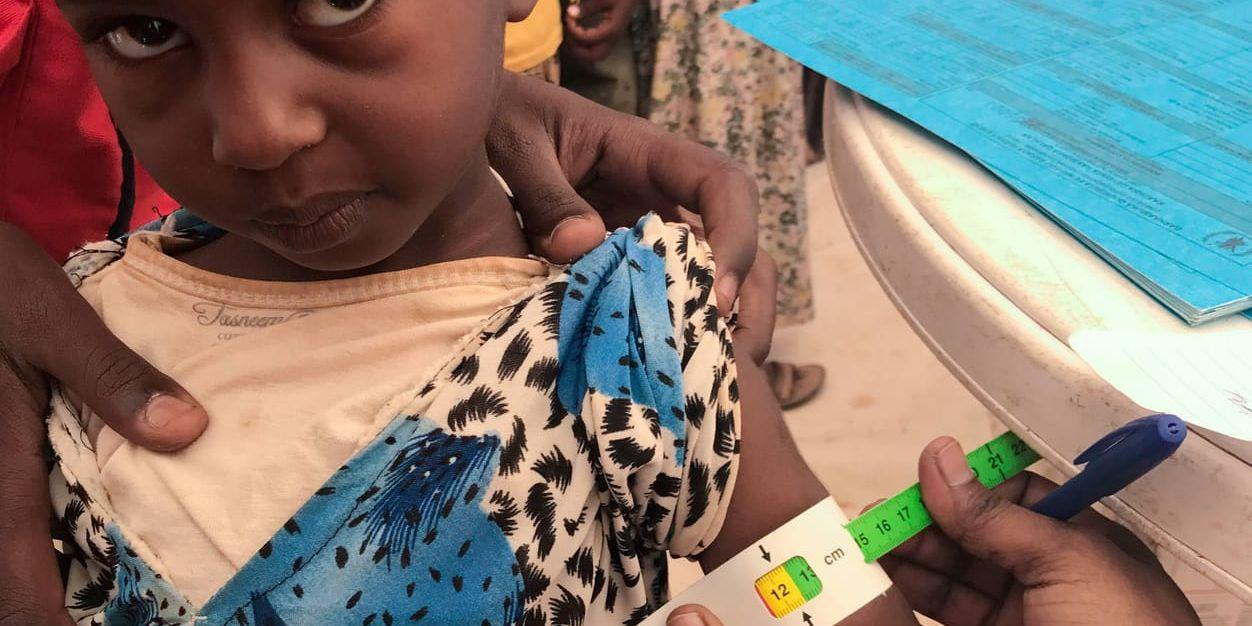 Fyraåriga Sem på en mobil hälsoklinik i ett flyktingläger i Aynabo i Somaliland. Runt armen har hon ett mätinstrument som snabbt kan visa om ett barn är undernärt. Grön färg innebär att barnet är väl nutrierat. Gult betyder att barnet är i riskzonen för undernäring. Orange färg visar medelmåttig malnutrition och röd färg innebär att barnet är allvarligt undernärt.