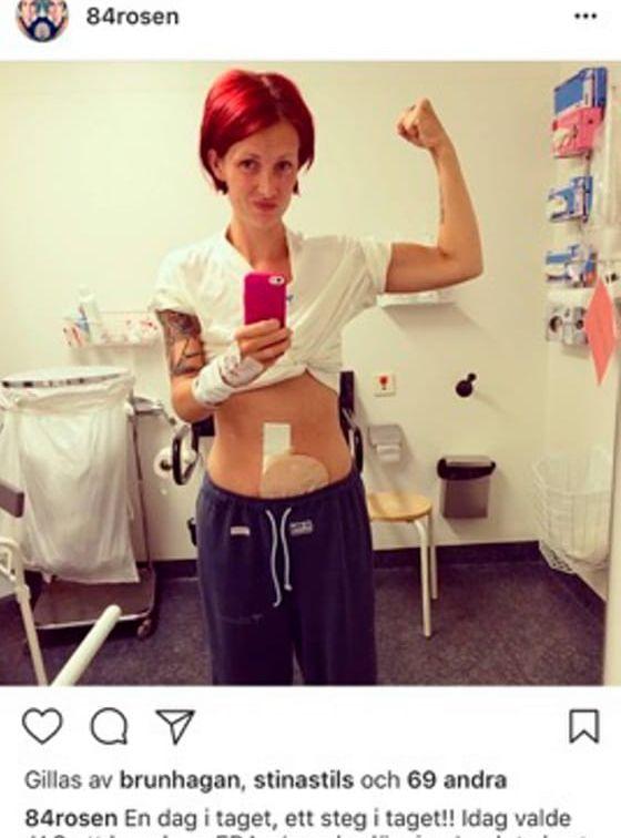 Strax efter operationen publicerade Rosanna den här bilden på instagram.