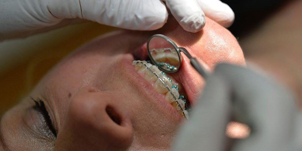 Allt fler skaffar tandställning. De senaste åren har statens kostnader för tandreglering ökat med 20 procent. ARKIVBILD.