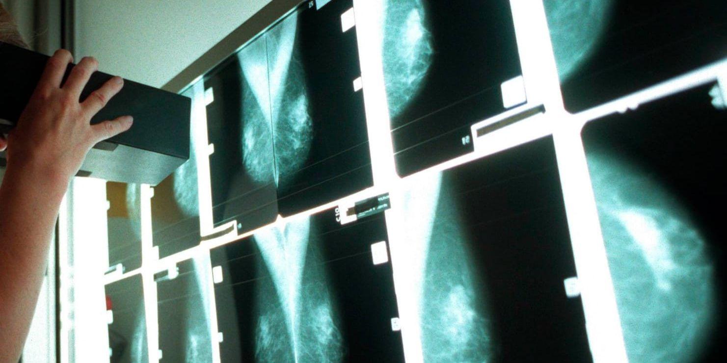 En bröstradiolog studerar röntgenplåtar. Plåtarna visar friska bröst. Arkivbild.