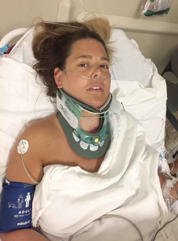 Cecilia Ohlsson före sin andra operation i mars 2017 då kotorna fem och sex i nacken åtgärdades via ett ingrepp i halsen. Ett ingrepp som också utförs i Sverige.