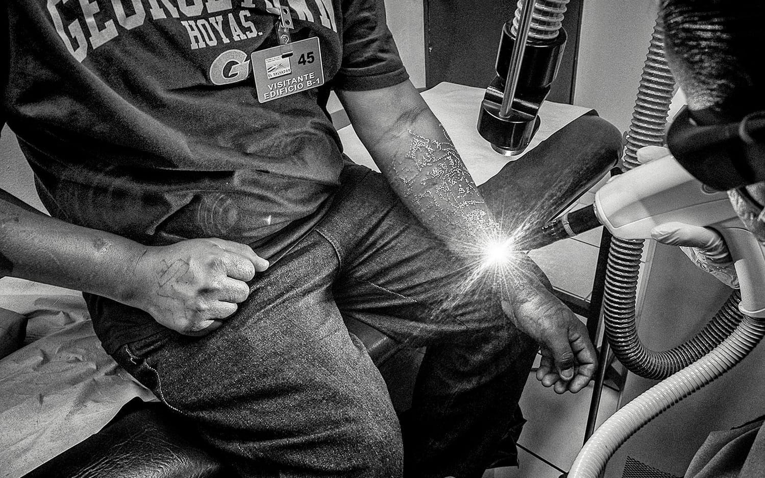 Laserbehandlinagrna får han genom ett speciellt program. En för detta gängmedlem måste visa flera rekommendationsbrev och bevisa att han lämnat gänget, till exempel med det id-kort man får av evangeliska kyrkor. Det krävs tiotals behandlingar för att få bort tatueringarna.