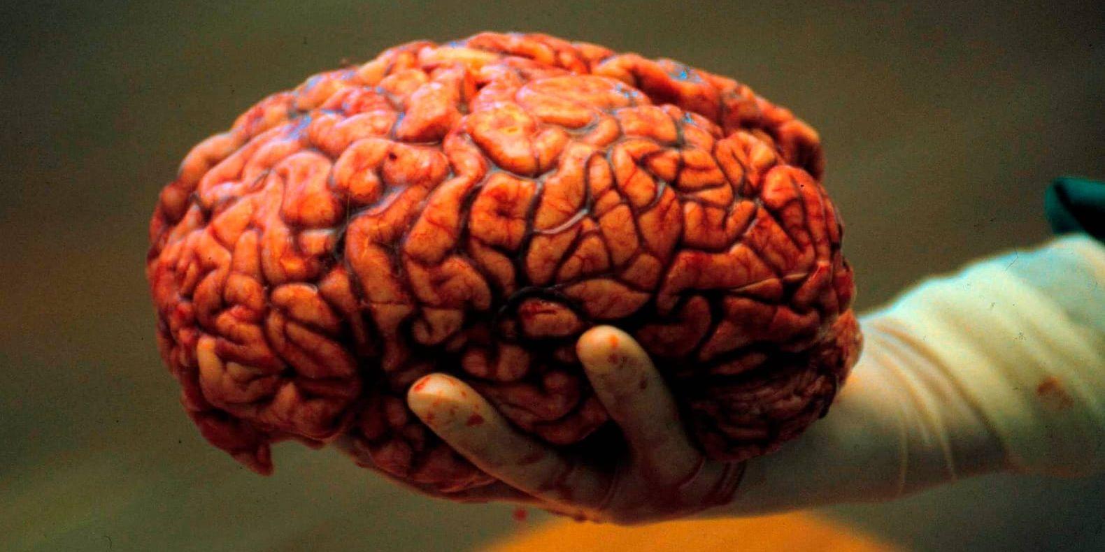 Den mänskliga hjärnans förmåga styrs av vissa gener. Arkivbild.