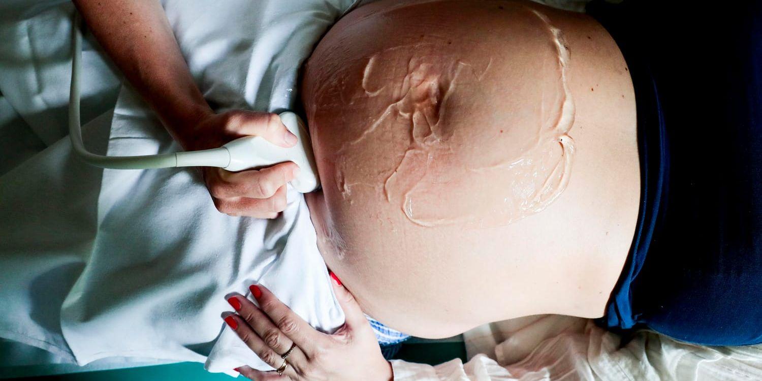 Stoppa onödigt ultraljud på foster, anser strålskyddsexpert. Arkivbild.