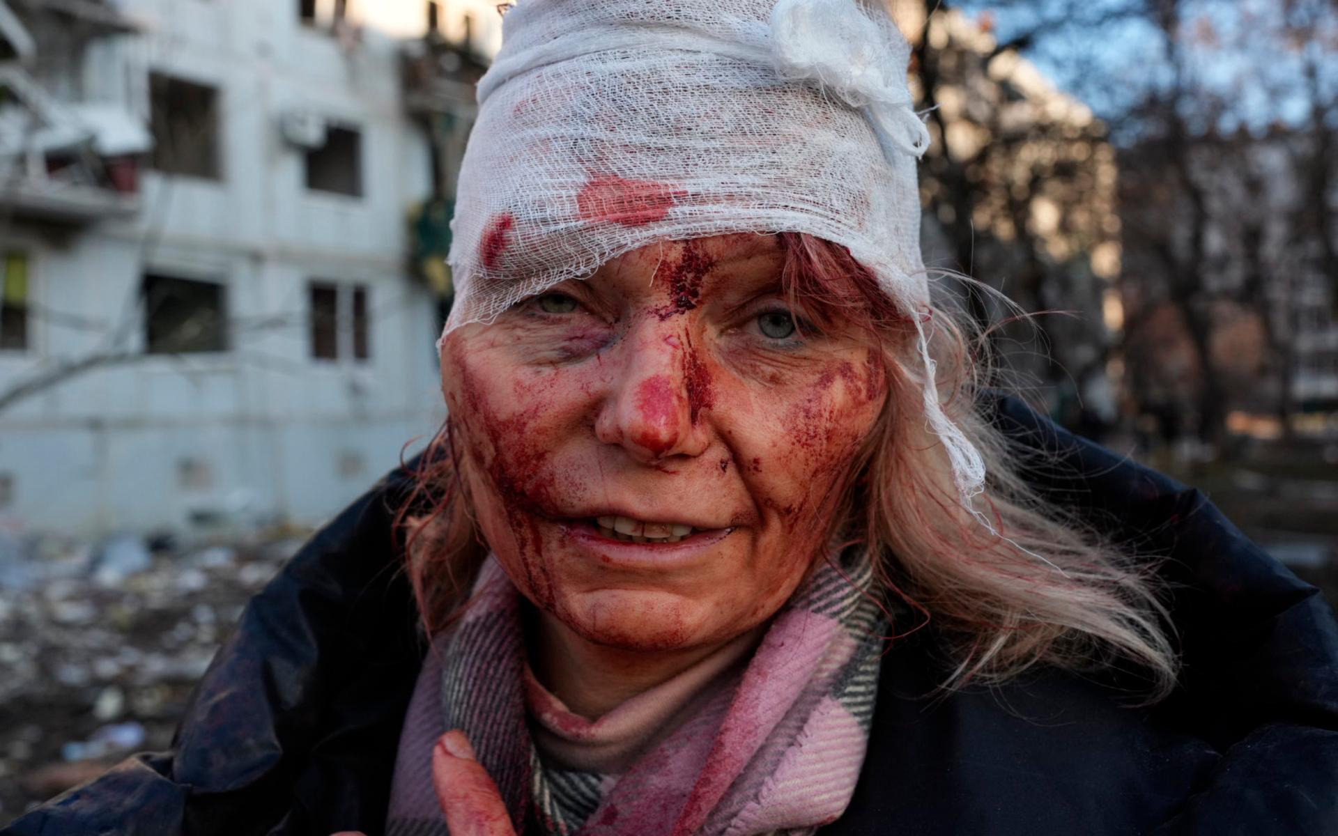 En kvinna som skadats under en attack mot ett bostadskvarter i Charkiv.