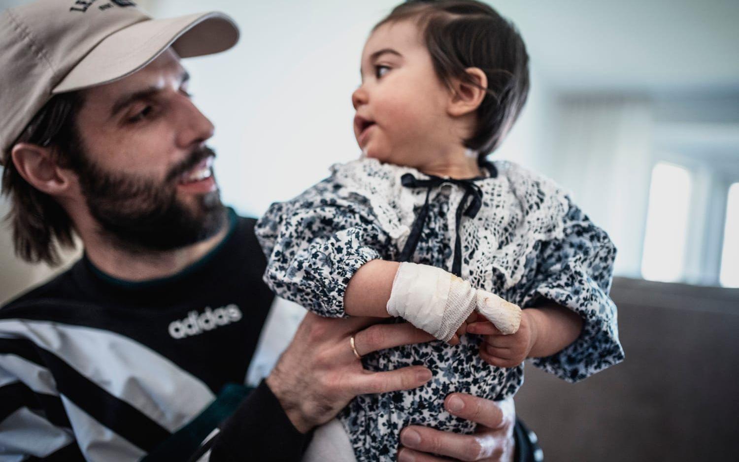 Shilera Sulhav och Mathias Renströms dotter Olivia fick ett finger sönderslitet av ett skötbord på Hede fashion outlet.