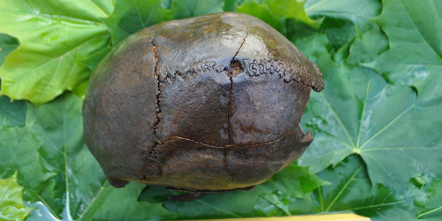 Ett kranium med en svår skada efter ett kraftigt slag mot huvudet. Kraniet, som hittats i Motala, är cirka 8 000 år gammalt, från mellersta stenåldern.