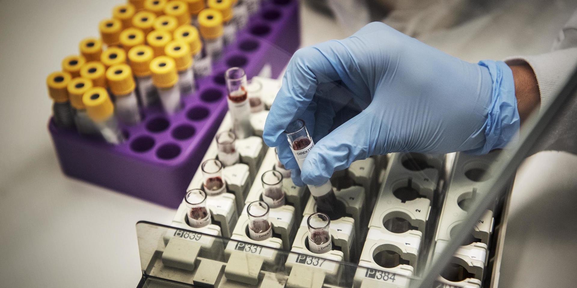 Sahlgrenska labb ansvar för PCR och antikroppstesterna på Sahlgrenskas lab och pratar om hur det går till att analysera testerna, hur det har sett ut under pandemin och vad de förväntar sig inför att det nu blir betydligt billigare att ta antikroppstest. Covid