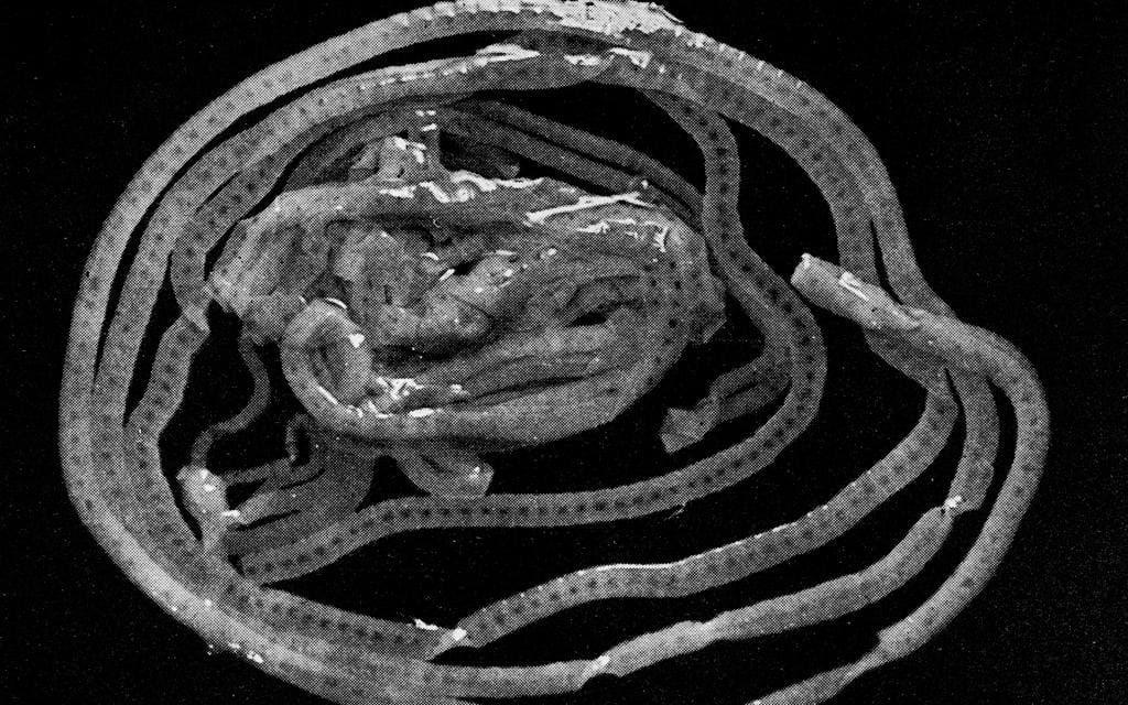 10. Binnikemasken. Den fruktade platta parasiten som bosätter sig i människor, och varje år dödar 700 personer. Bild: TT