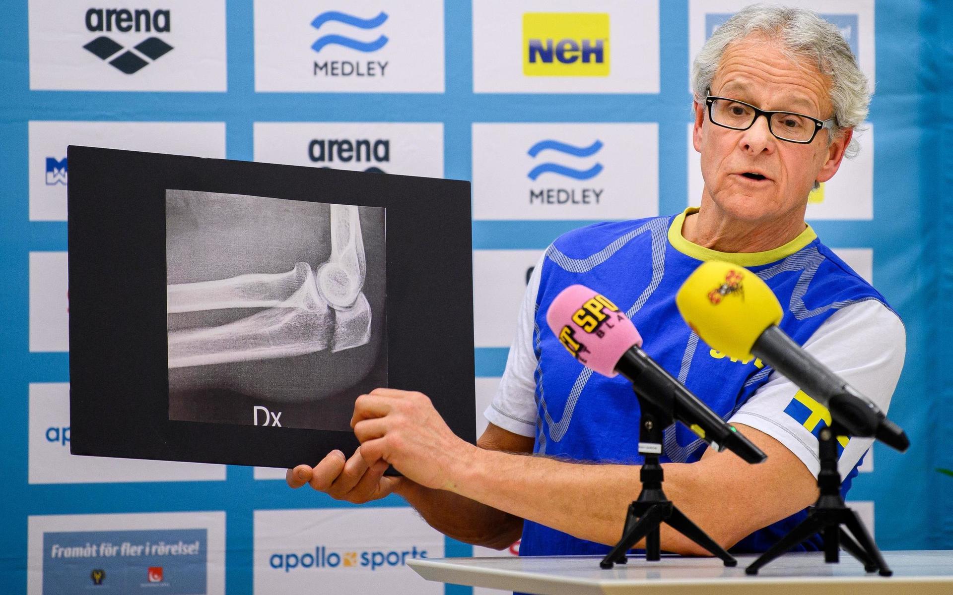 Sveriges lagläkare René Tour under en presskonferens med anledning av Sarah Sjöströms armbågsbrott den 7 februari.