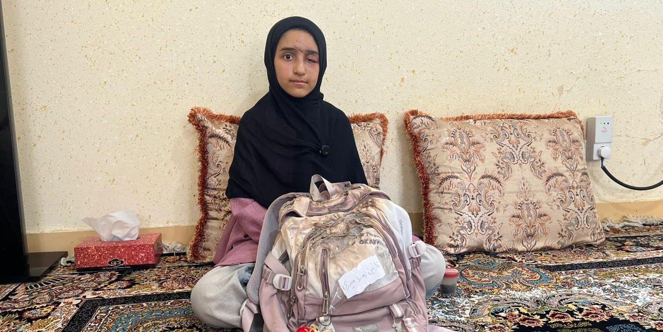 En flicka med skadat öga sitter med en bränd ryggsäck.