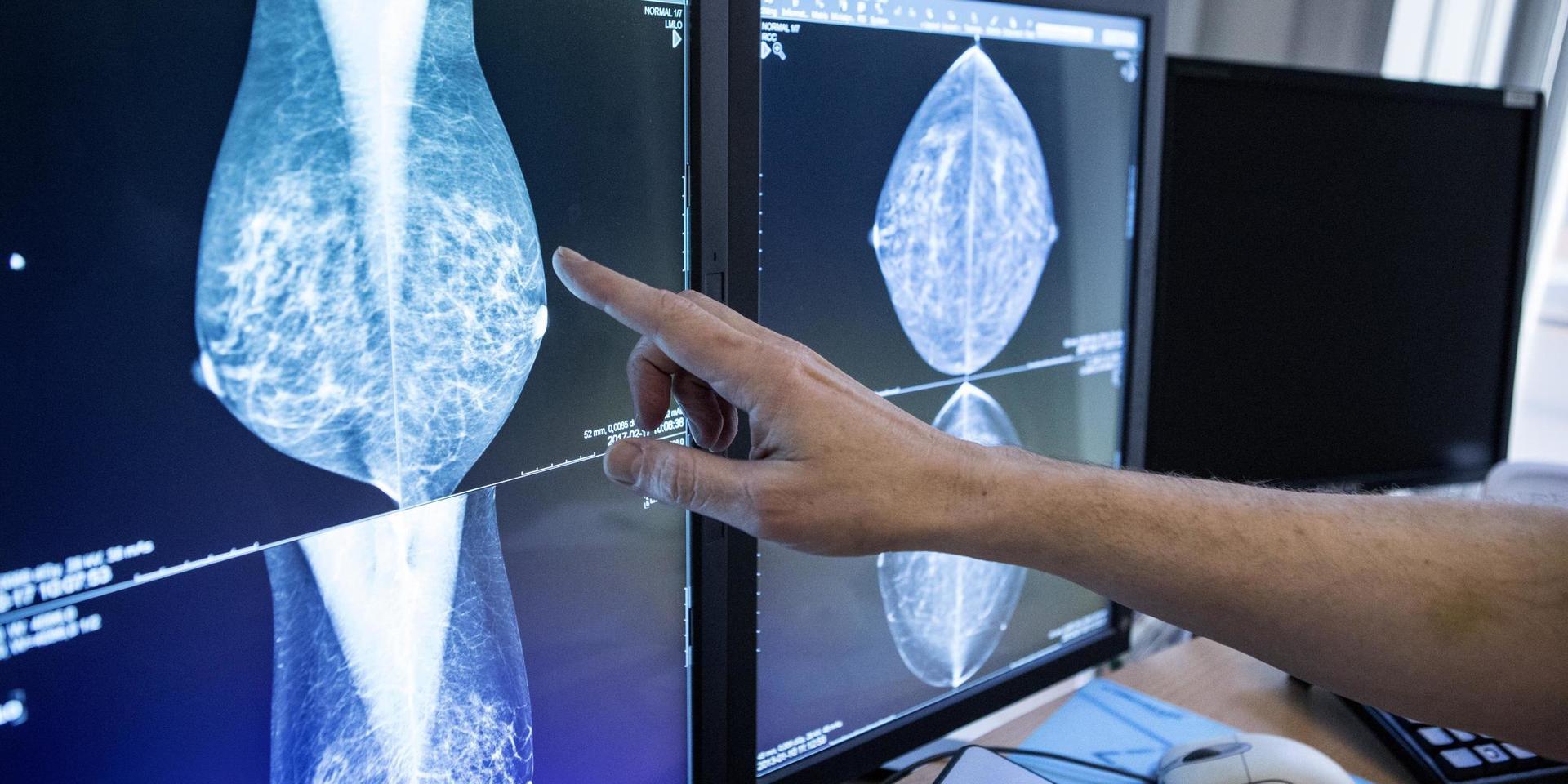 Mammografiscreening pausades i flera regioner under våren som en konsekvens av coronapandemin. Arkivbild.
