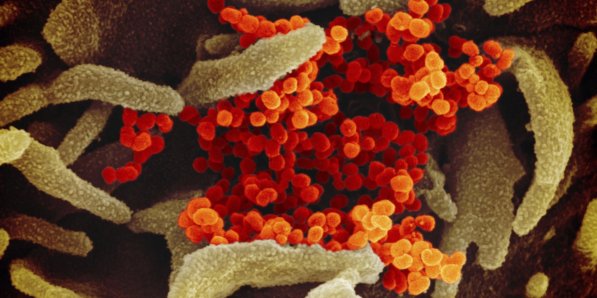 Coronavirus SARS-CoV-2 i orange, förstorat.