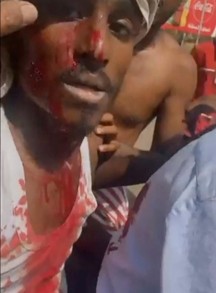En ung man med skador under protesterna i Khartoum på måndagen.