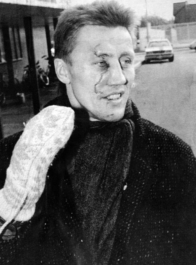 En känd händelse i Börje Salmings karriär var olyckan 1986, då en spelare råkade trampa honom i ansiktet med en skridsko. Börje kunde mycket förlorat synen, eller till och med dött – men ”kom undan” med 300 stygn i ansiktet. 