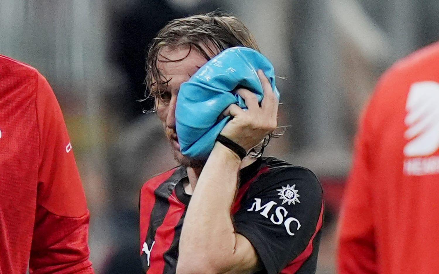 Luka Modric måste opereras för en fraktur i vänster kindben.