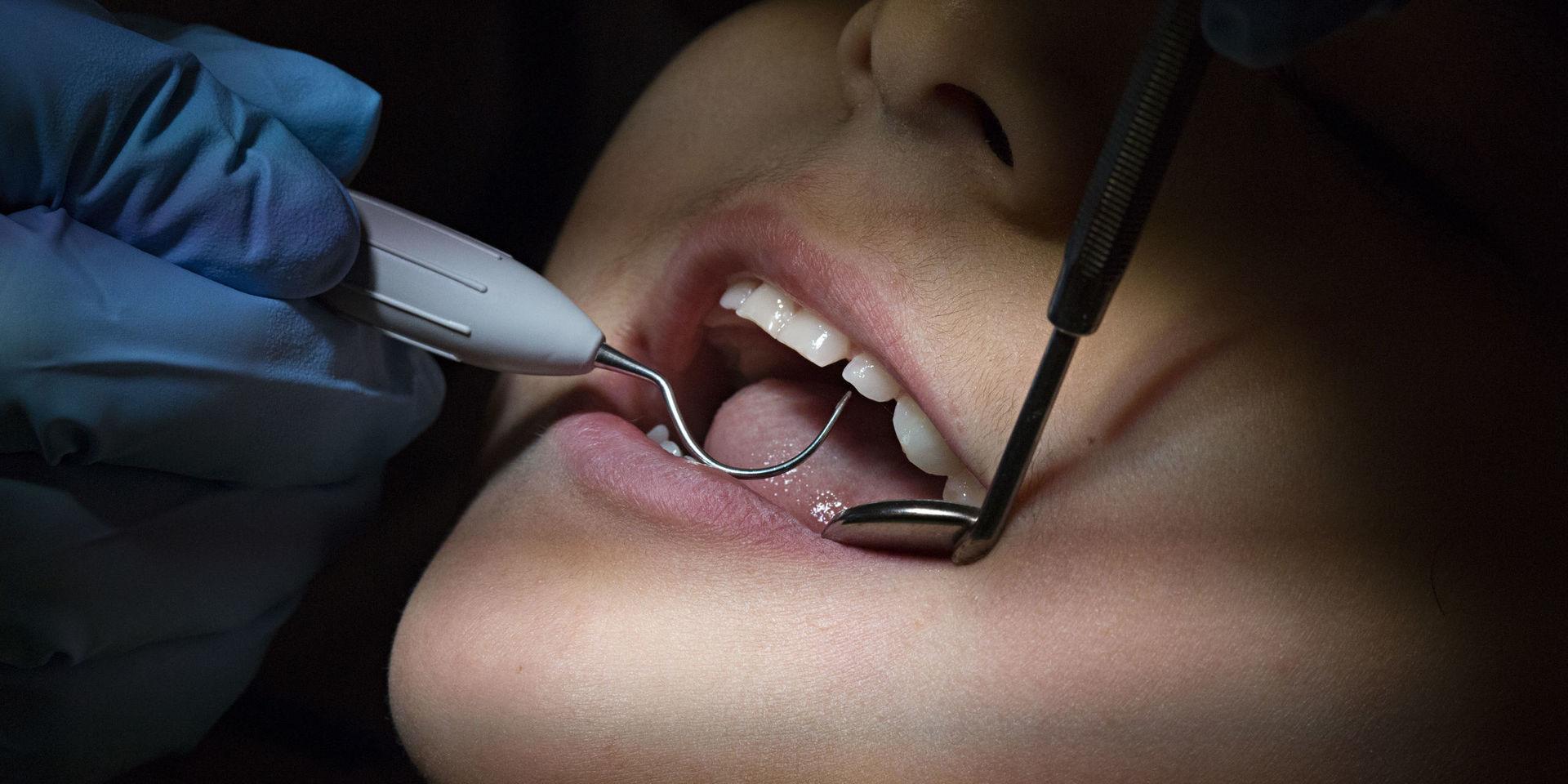 Ett 50-tal privata tandläkarkliniker har avslöjats med skattefusk. Arkivbild.