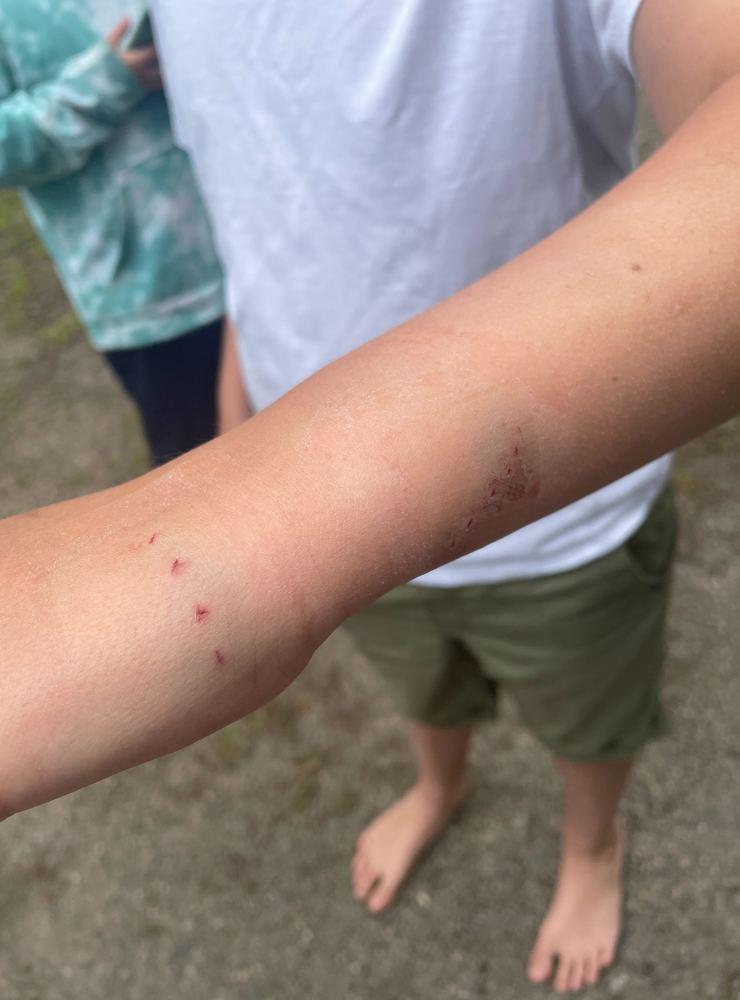 11-åriga Arvid Andersson kände hur något högg honom i armen och sedan hur en fiskkropp slog emot honom när den simmade därifrån.