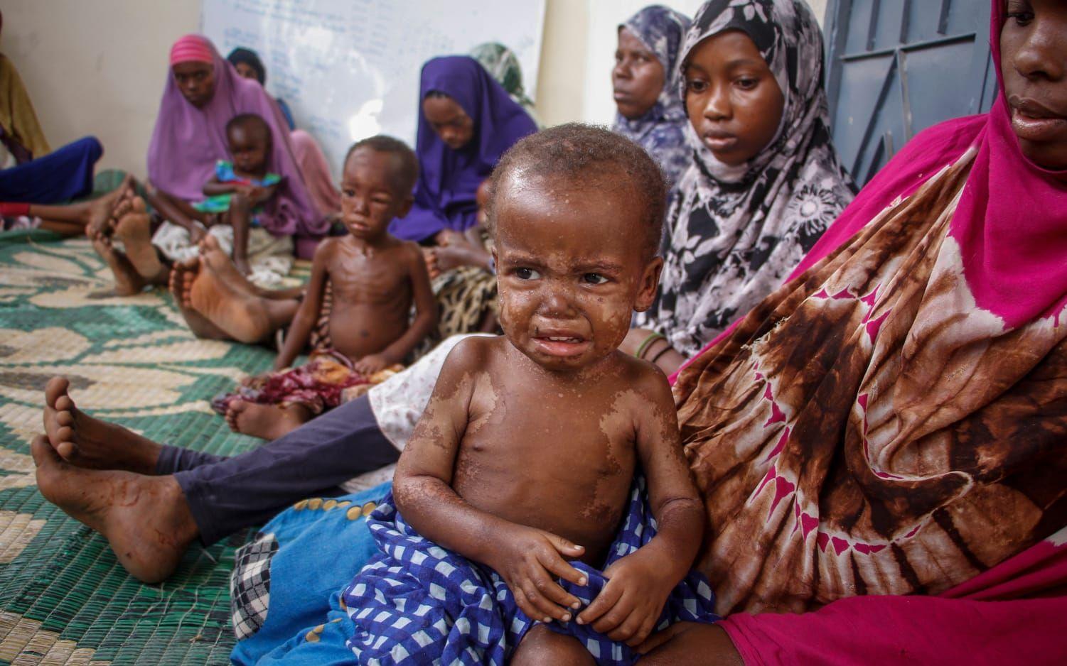 Enligt FN har 448 barn i Somalia dött i år till följd av akut undernäring.