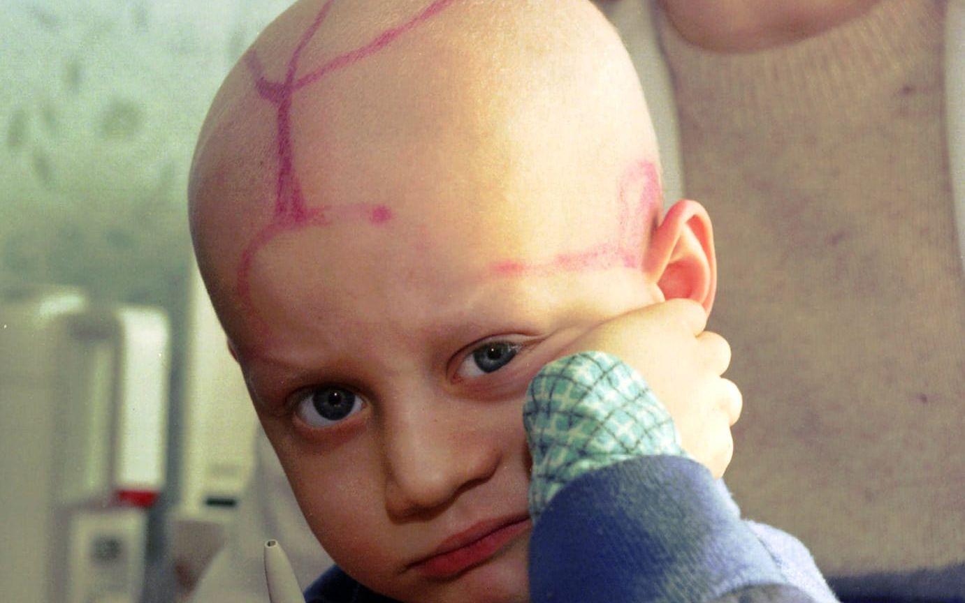 Femårige Alek Zhloba i Vitryssland var inte ens född när Tjernobylkatastrofen inträffade men är väl bekant med dess eftereffekter. På den här bilden från 1996 ser man märken efter hans många behandlingar mot leukemi , en följdeffekt av det radioaktiva nedfallet .
