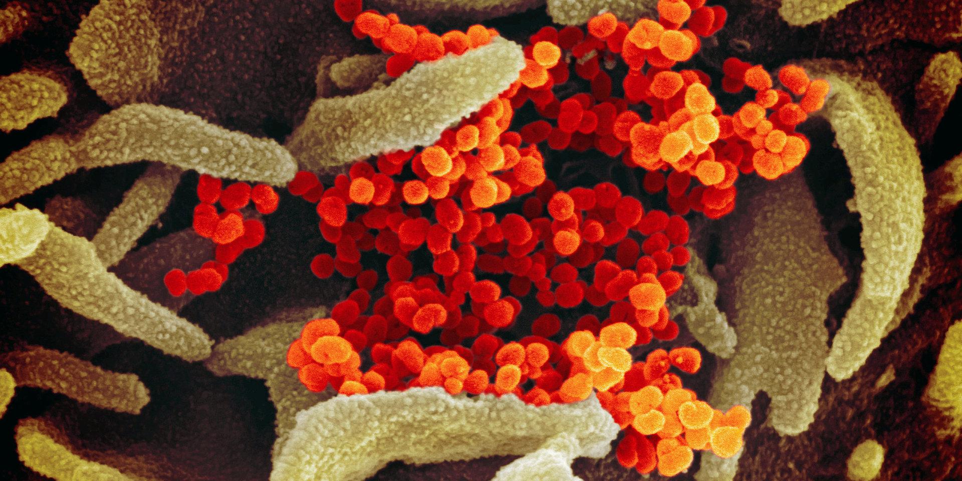 Bild av coronaviruset (orange) i ett elektronmikroskop.