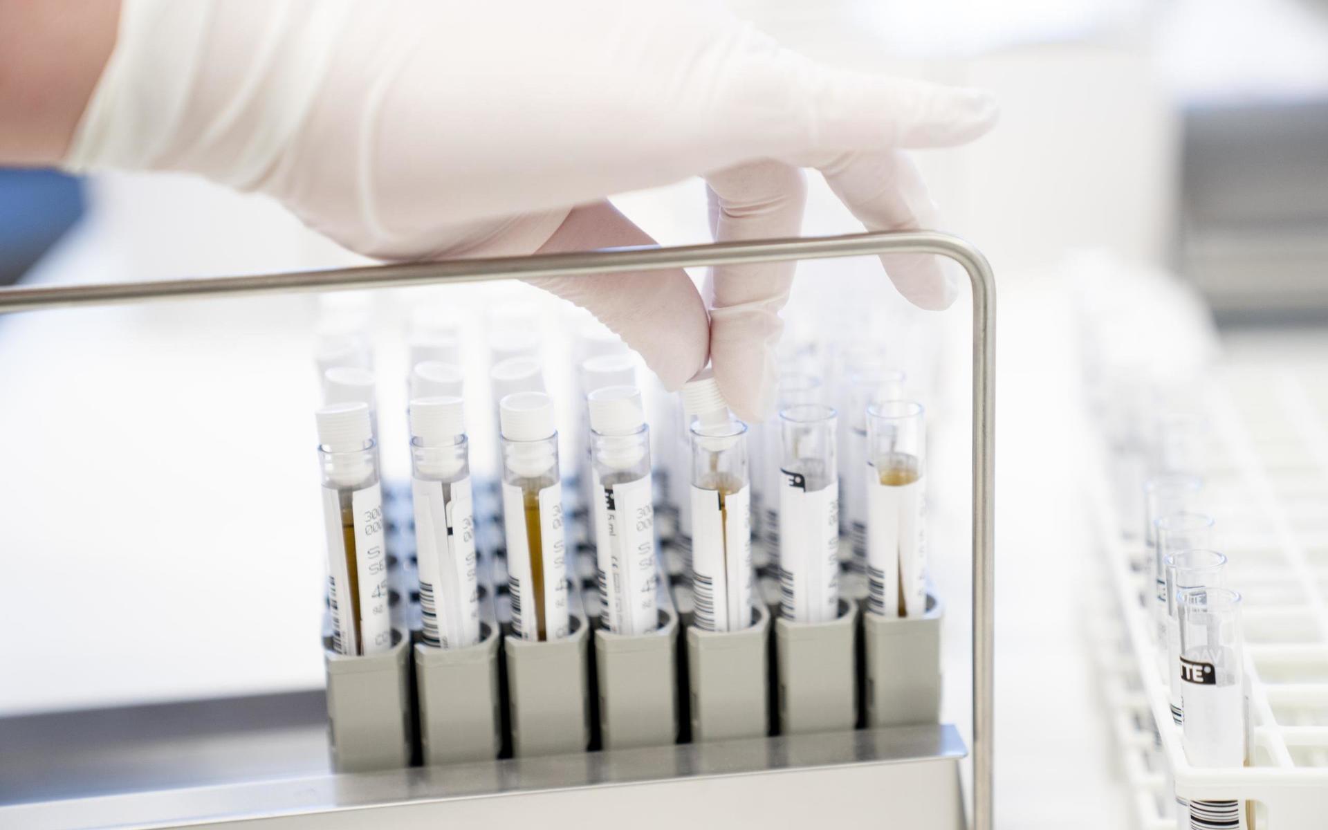 Ungefär 12 procent av proverna var positiva i Västra Götaland vecka 4. Nästan 34 000 PCR-tester utfördes, enligt regionens statistik.