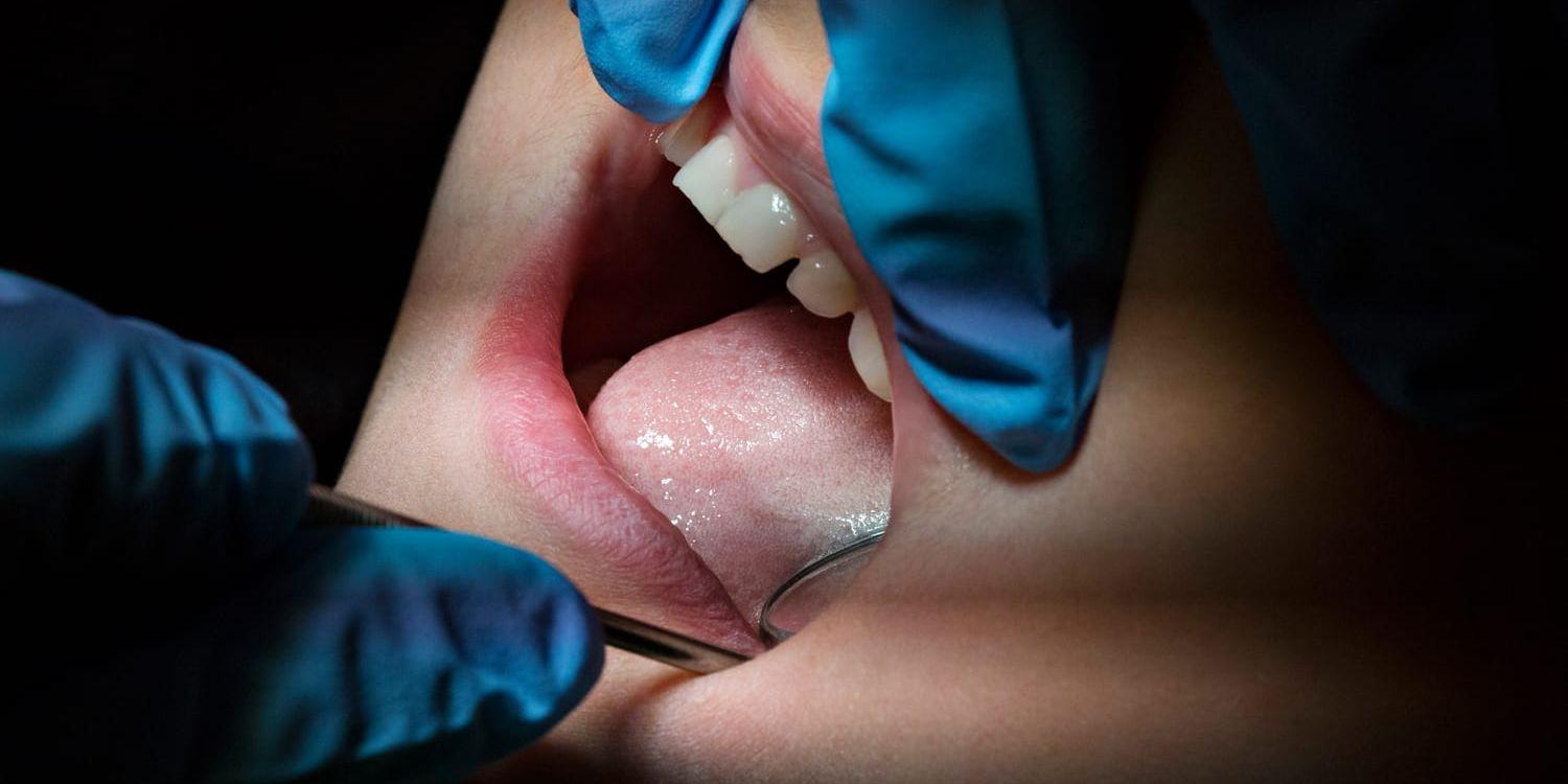 En ökning av tandlossningssjukdomen parodontit upptäcktes när data från över 1 000 15-åringar granskades. Arkivbild.
